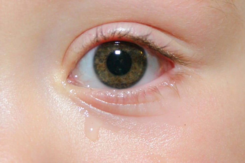 Hinter tränenden Augen bei Kindern steckt nicht immer ein Fremdkörper.
