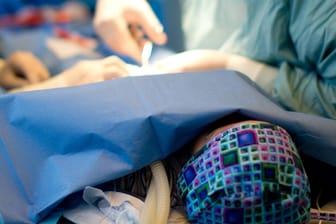 Beschneidung: Ein Arzt operiert einen zweijährigen Jungen.