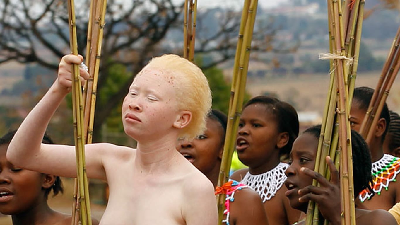 Nicht überall werden Albinos gejagt: Ein Albino-Mädchen nimmt an einem rituellen Tanz in Swasiland teil.