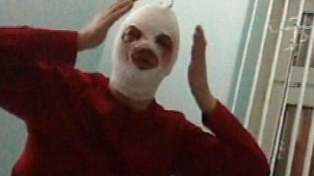 Balletchef Sergej Filin nach dem Säureangriff. Russische Medien berichten über mögliche Zeugen. Balletchef Sergej Filin nach dem Säureangriff. Russische Medien berichten über mögliche Zeugen.