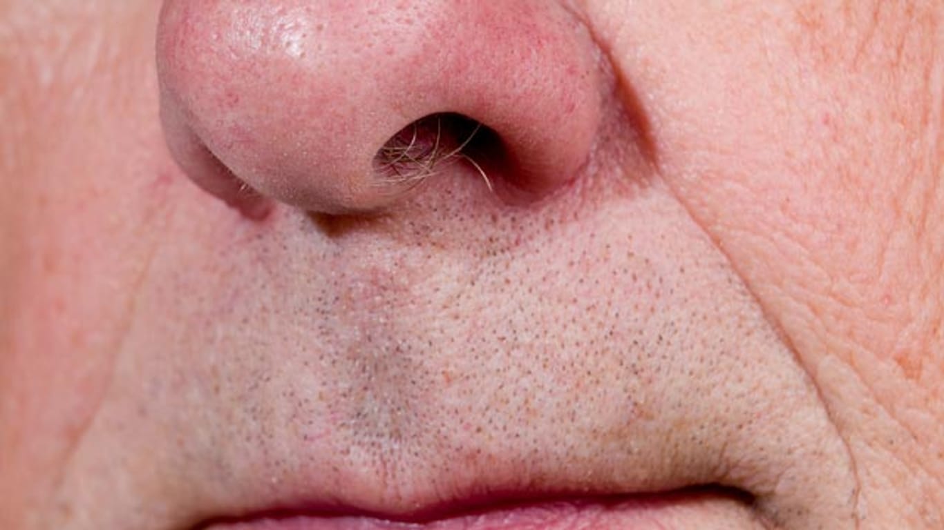 Nasenhaare wachsen bei Männern im Alter stärker.