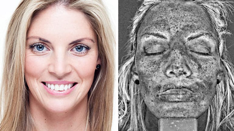 Solarium: Kelly Hughes (30) in normaler Ansicht (links) und unter dem UV-Scanner (rechts).