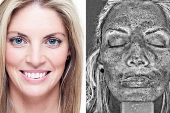 Solarium: Kelly Hughes (30) in normaler Ansicht (links) und unter dem UV-Scanner (rechts).