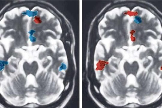 Partnerschaft: Gehirnscans zeigen Chancen.