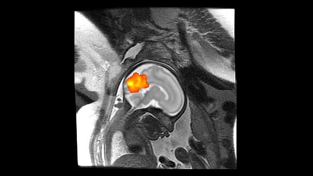 Gehirnentwicklung: Es sind die ersten Aufnahmen, die die Gehirnentwicklung eines Fötus dokumentieren.