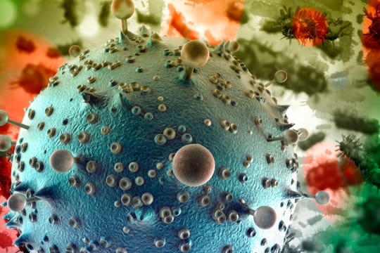 Eine vergrößerte HIV-Zelle