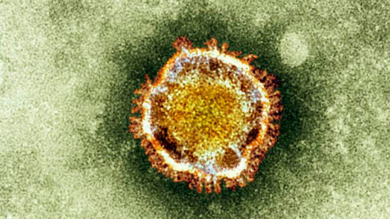 Der neuartige Coronavirus unter einem Elektronenmikroskop