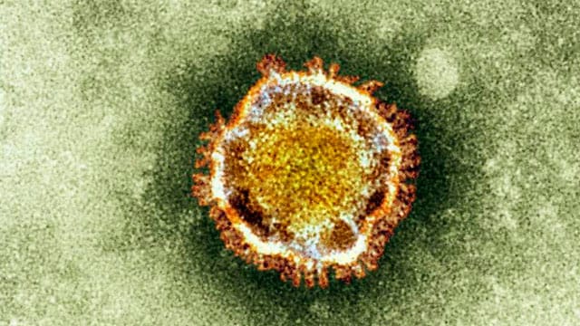 Der neuartige Coronavirus unter einem Elektronenmikroskop