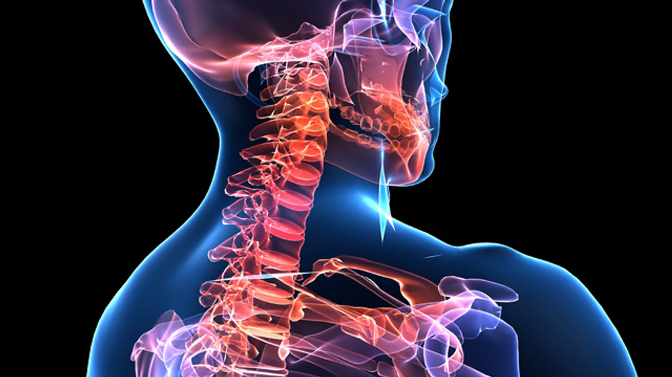 Schwachstelle: Die meisten Menschen leiden irgendwann an Nackenschmerzen
