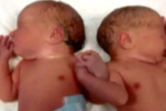 Nach ihrer Geburt umfassten die Zwillinge Danel und Maria sofort ihre Hände.