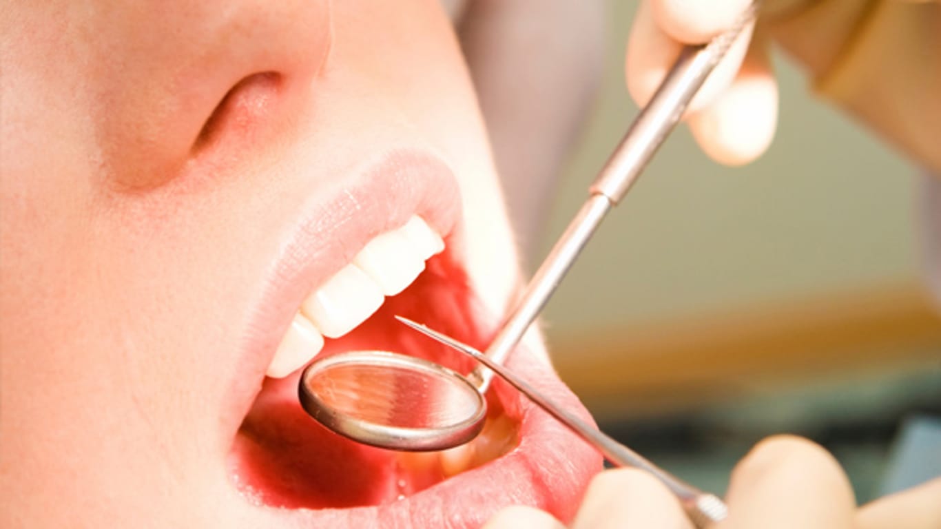 Blutdrucksenkende Medikamente können zu Zahnfleischwucherungen führen.