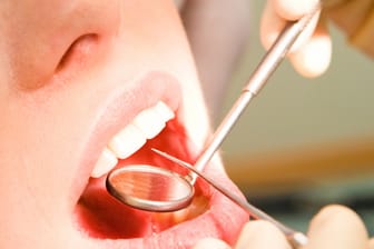 Blutdrucksenkende Medikamente können zu Zahnfleischwucherungen führen.