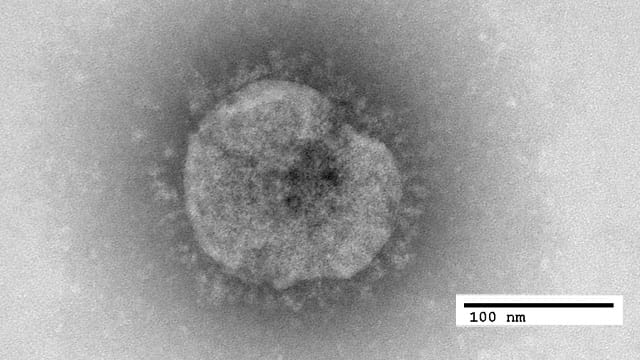 Mediziner wissen noch zu wenig über das Coronavirus