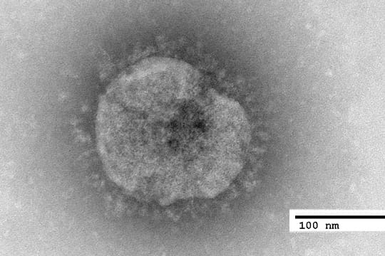 Mediziner wissen noch zu wenig über das Coronavirus
