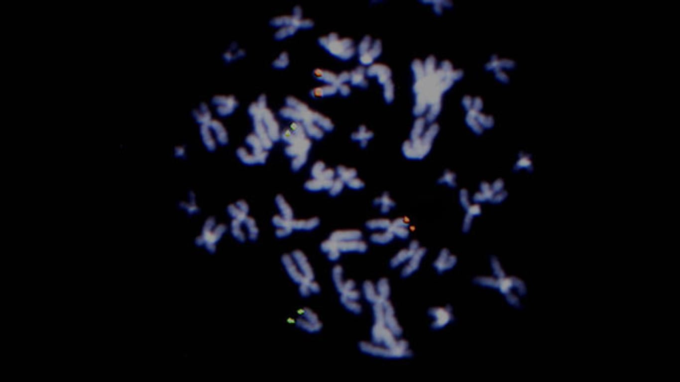 Chromosomen unterm Mikroskop