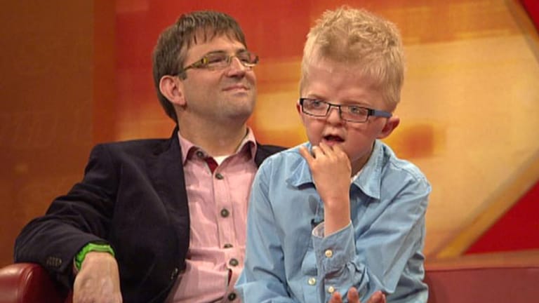 Apert-Syndrom: Simon ist zehn und wurde mit schweren Fehlbildungen geboren.