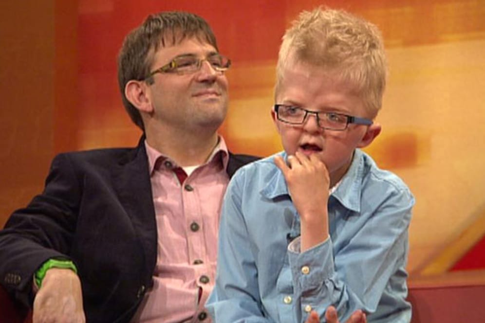 Apert-Syndrom: Simon ist zehn und wurde mit schweren Fehlbildungen geboren.
