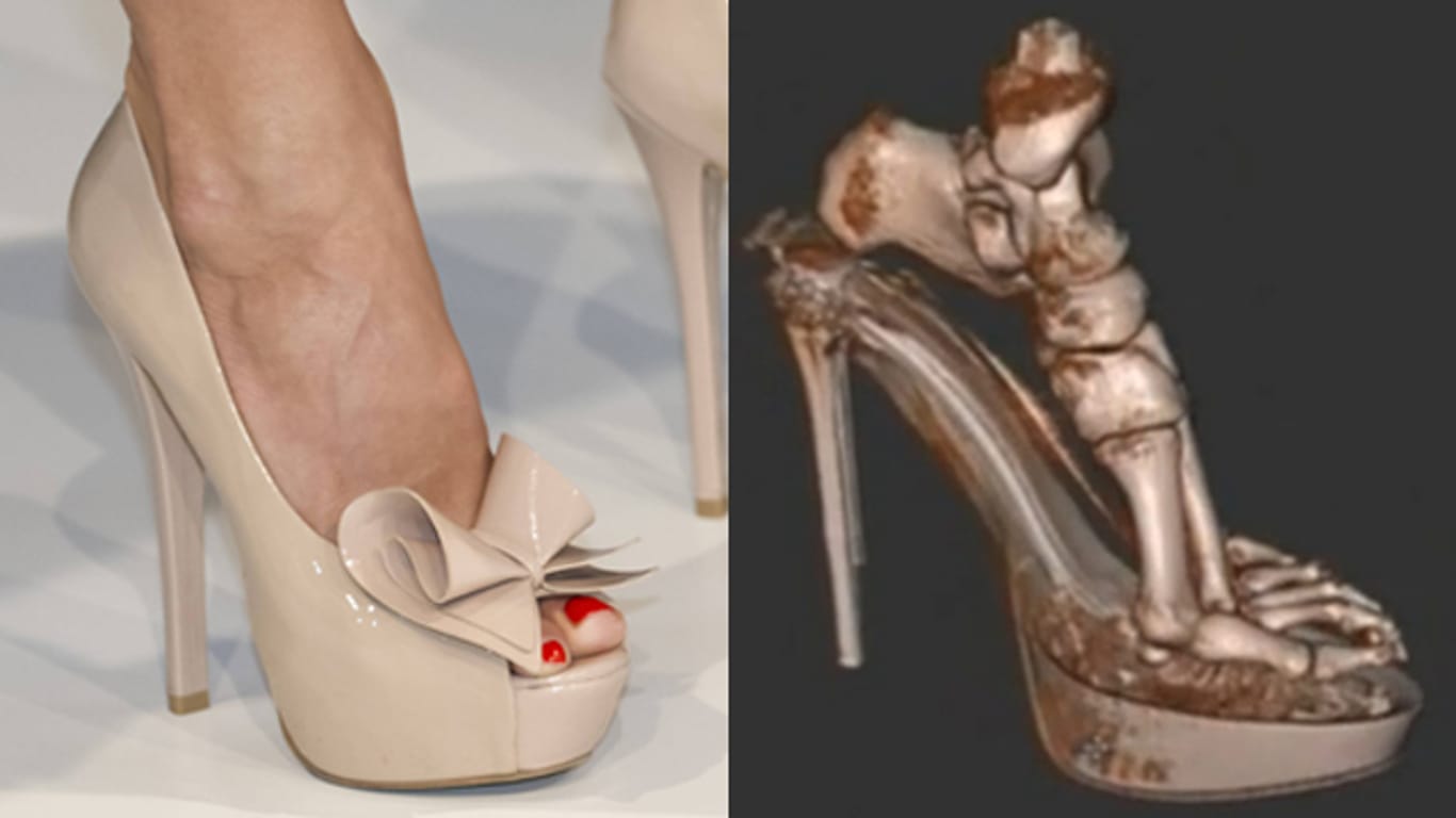 Fuß: Ein neuartiger 3-D-Scanner zeigt, wie schädlich das Tragen von High Heels sein kann.