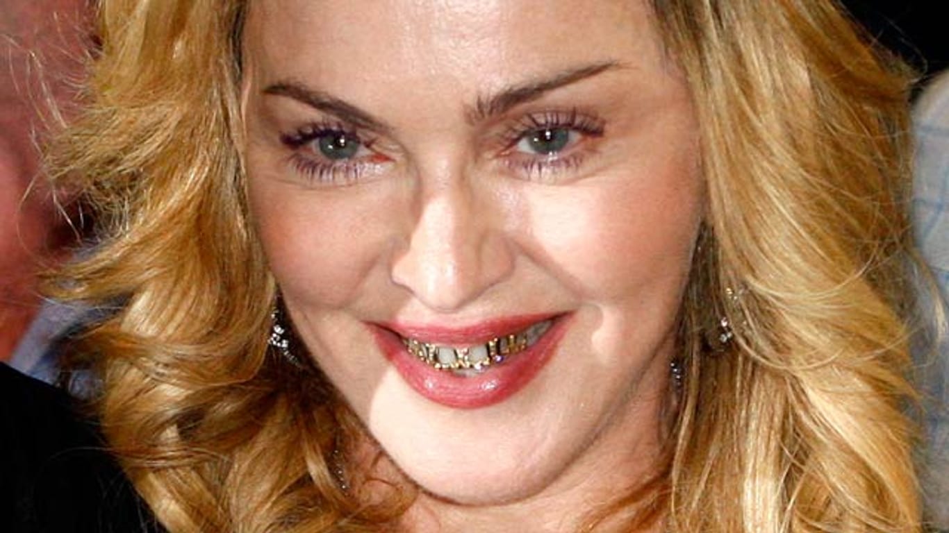 Zähne: Madonna posiert mit goldenen Grillz - ein angesagter Zahnschmuck.