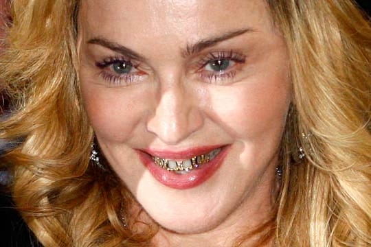 Zähne: Madonna posiert mit goldenen Grillz - ein angesagter Zahnschmuck.