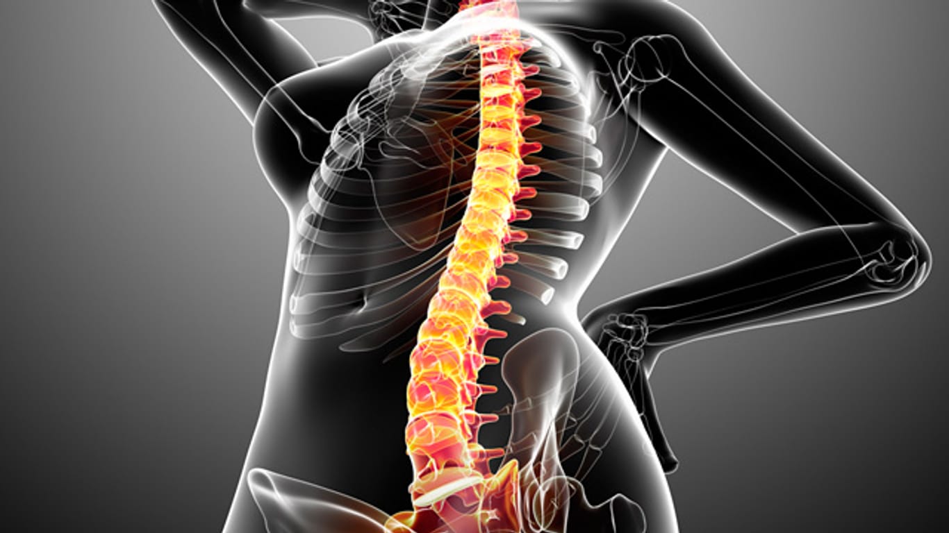 Rückenschmerzen: Bakterien können möglicherweise der Auslöser für chronische Rückenschmerzen sein.