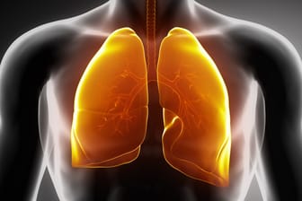 Lungenkrankheiten: Jeder zehnte Todesfall geht auf Lungenkrankheiten zurück.