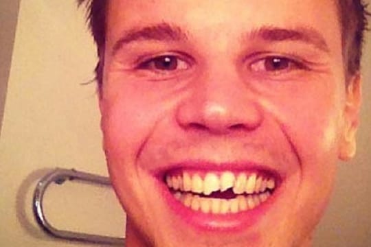 Mitch Langerak nimmt die abgebrochenen Schneidezähne mit Humor.