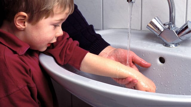 Um Schlimmeres zu verhindern, können Sie die betroffene Hautfläche kann mit lauwarmen Wasser abspülen