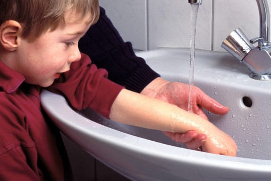 Um Schlimmeres zu verhindern, können Sie die betroffene Hautfläche kann mit lauwarmen Wasser abspülen