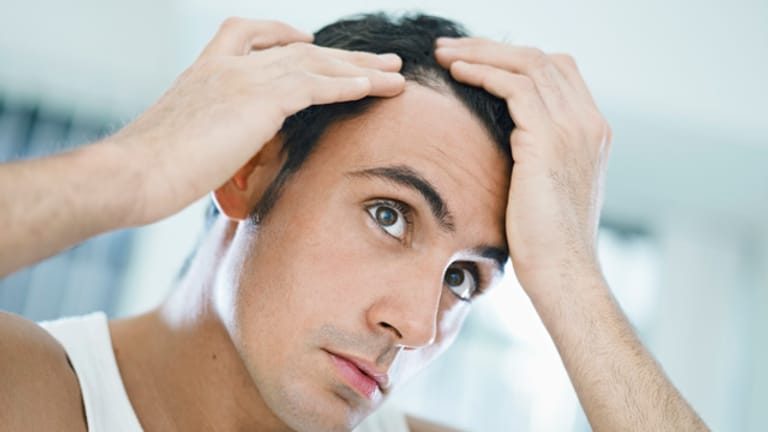 Viele Männer leiden unter Haarausfall.