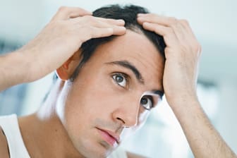 Viele Männer leiden unter Haarausfall.