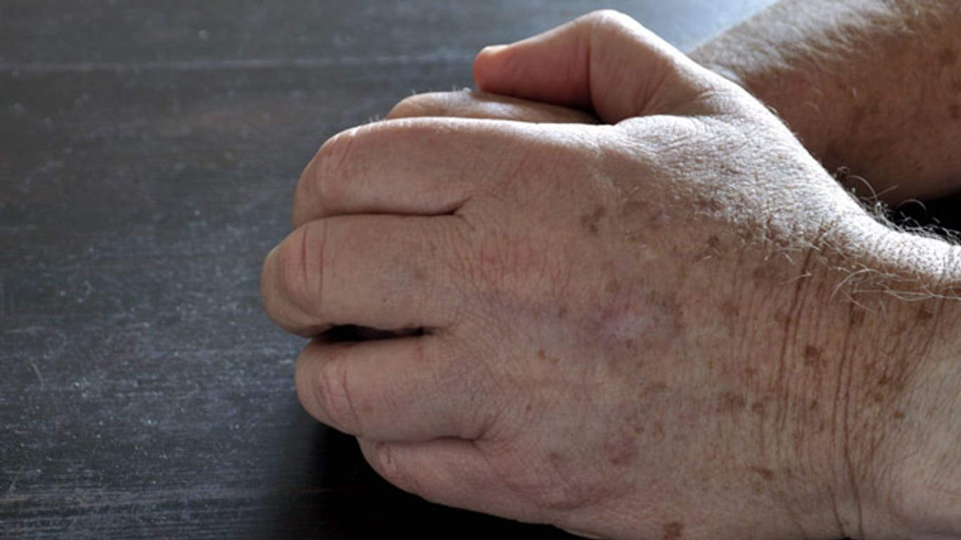 Mit zunehmendem Alter verändert sich auch die Haut. Besonders Altersflecken auf den Händen sind weit verbreitet.