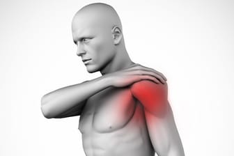 Polymyalgia rheumatica löst anfangs oft Schulterschmerzen aus.