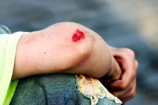 Hinter mancher Schramme steckt eine Misshandlung, Ärzte sind darauf jedoch nicht immer vorbereitet.