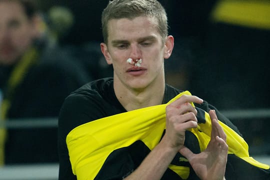 Sven Bender erlitt eine Nasenverletzung im Spiel gegen den SSC Neapel.
