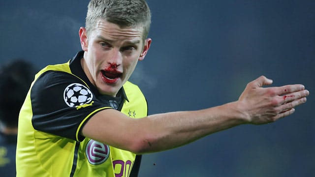 Voller Einsatz: Auch eine gebrochene Nase konnte Dortmunds Sven Bender gegen Neapel nicht bremsen. Voller Einsatz: Auch eine gebrochene Nase konnte Dortmunds Sven Bender gegen Neapel nicht bremsen.