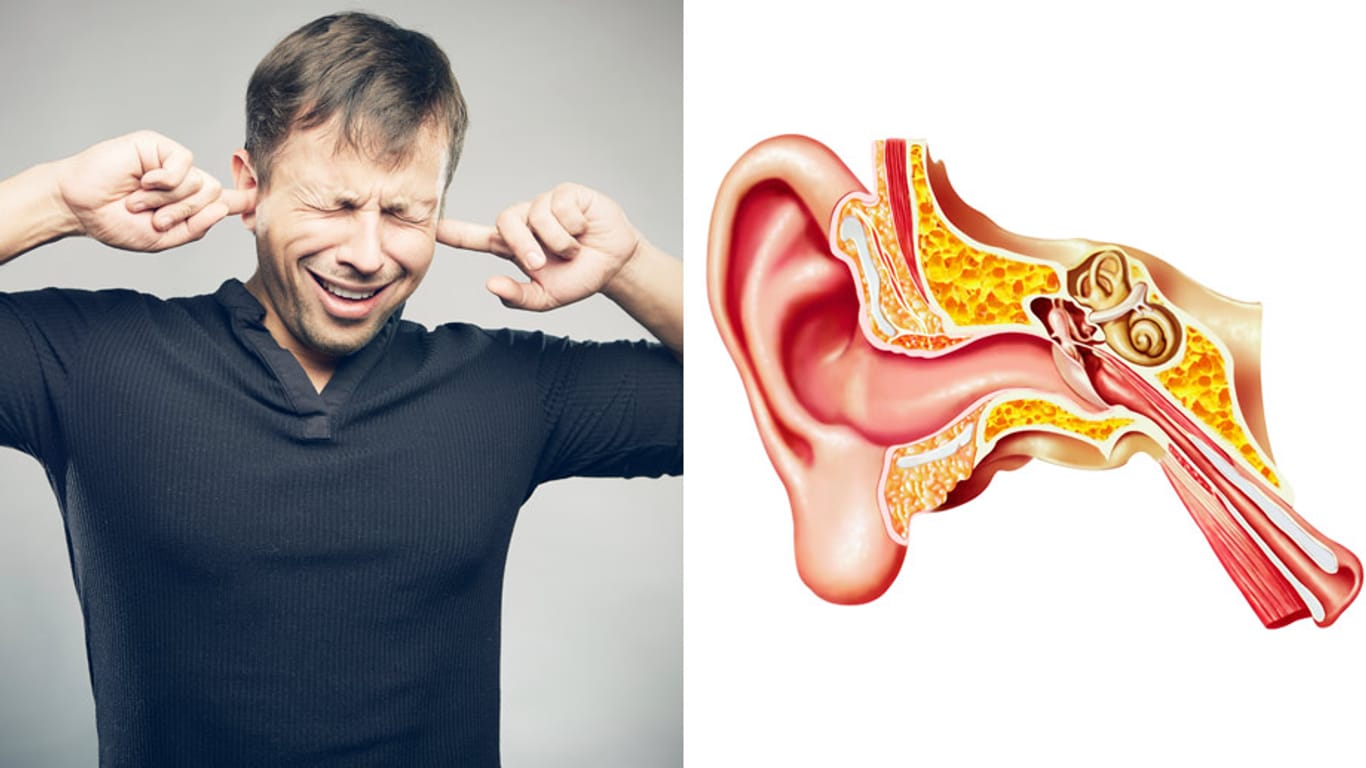 Otosklerose: Ein verkalktes Ohr trifft besonders Menschen zwischen 20 und 40.