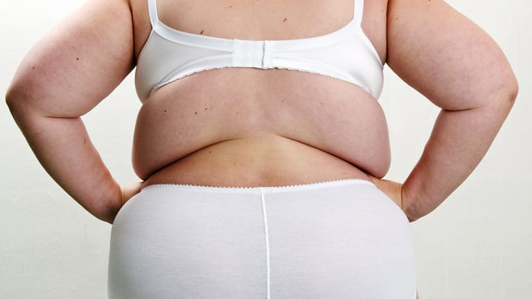 Fettleibigkeit: Die Zahl der Adipositas-Operationen steigt stetig.