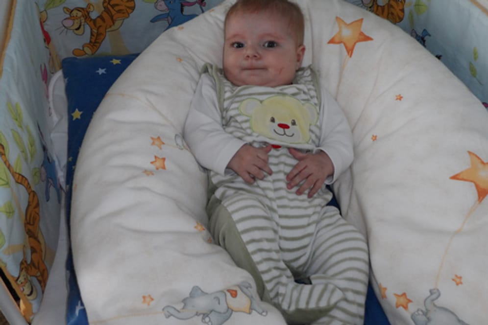 Angeborener Herzfehler: Sophia ist noch am Leben, weil ihre Eltern sie nicht aufgegeben haben.