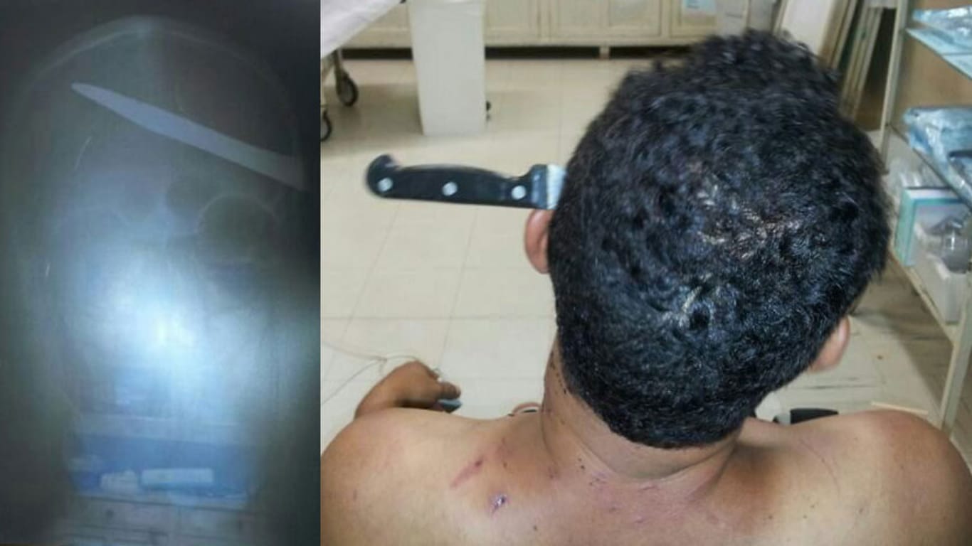 Die Militärpolizei von Sao Paulo verbreitete ein Bild des offensichtlich robusten Mannes samt Röntgenaufnahme