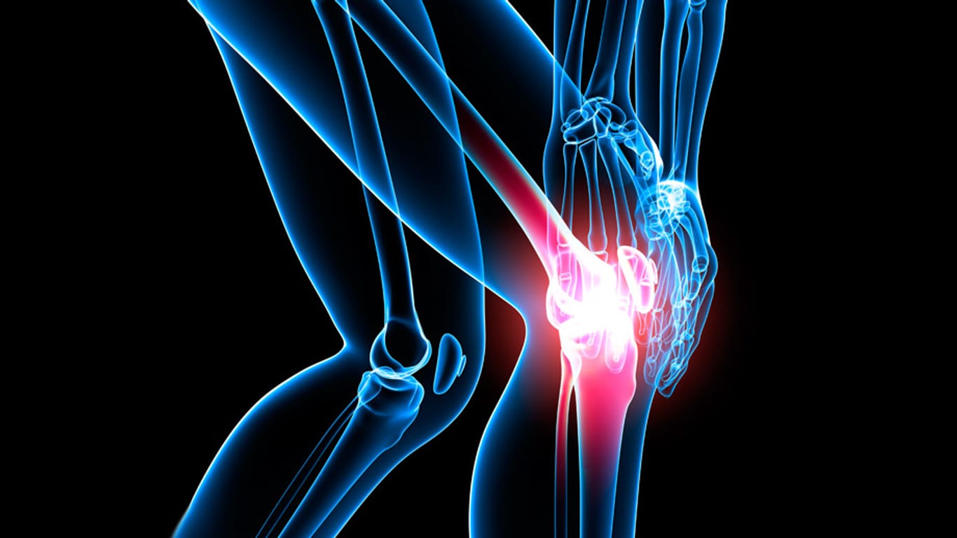 Arthrose: Vor allem Knie-, Hüft- und Schultergelenke sind von Arthrose betroffen.
