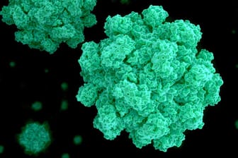 Ansteckende Noroviren: Bereits zehn bis 100 Viren reichen für eine Infektion aus.