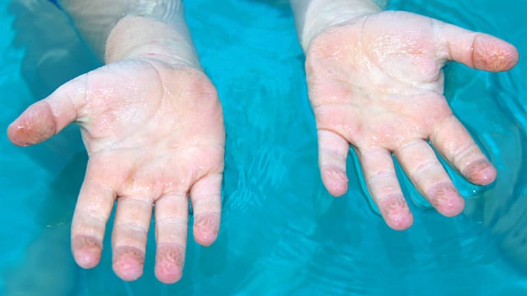 HautForschung Rätsel der Schrumpelfinger nach dem Baden gelöst