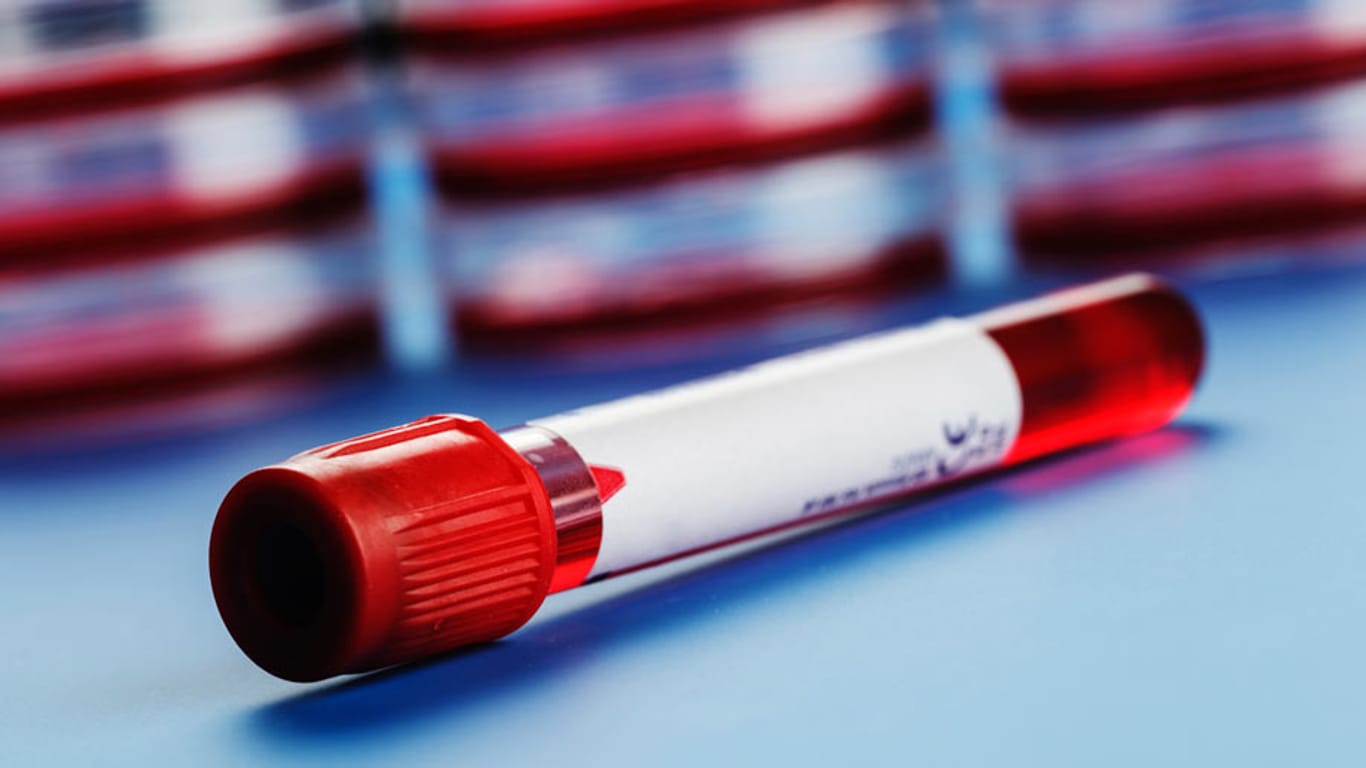 Der EDIM-Bluttest stellt einen Meilenstein in der Krebsdiagnostik dar. Der Test ist bereits kommerziell erhältlich.