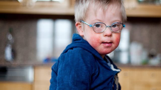 Ingmar (5) war an der extrem seltenen Down-Syndrom-Leukämie erkrankt. Heute gilt er als geheilt. Ingmar (5) war an der extrem seltenen Down-Syndrom-Leukämie erkrankt. Heute gilt er als geheilt.