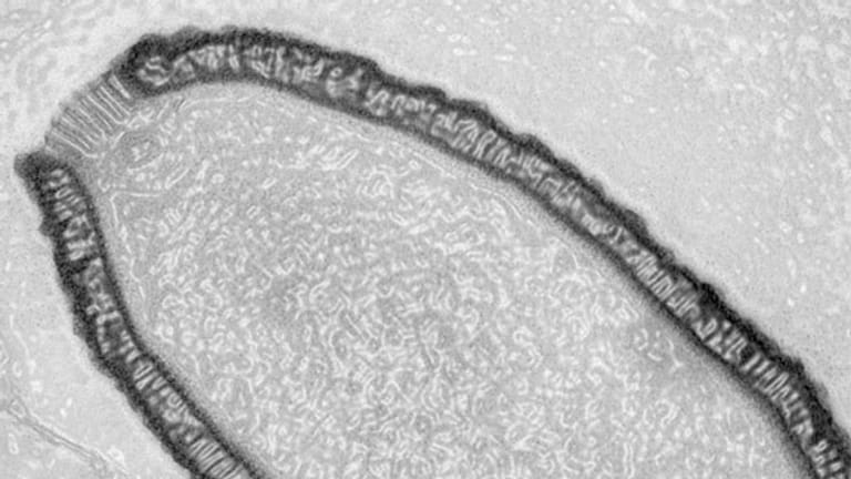 Das jetzt entdeckte Riesenvirus war 30.000 Jahre im Ewigen Eis verborgen