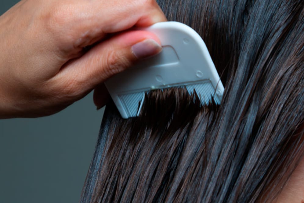 Unabhängig davon, ob die Haare frisch gewaschen sind: Die Übertragung von Läusen über den Kopf zählt zu den häufigsten Ursachen des Befalls.