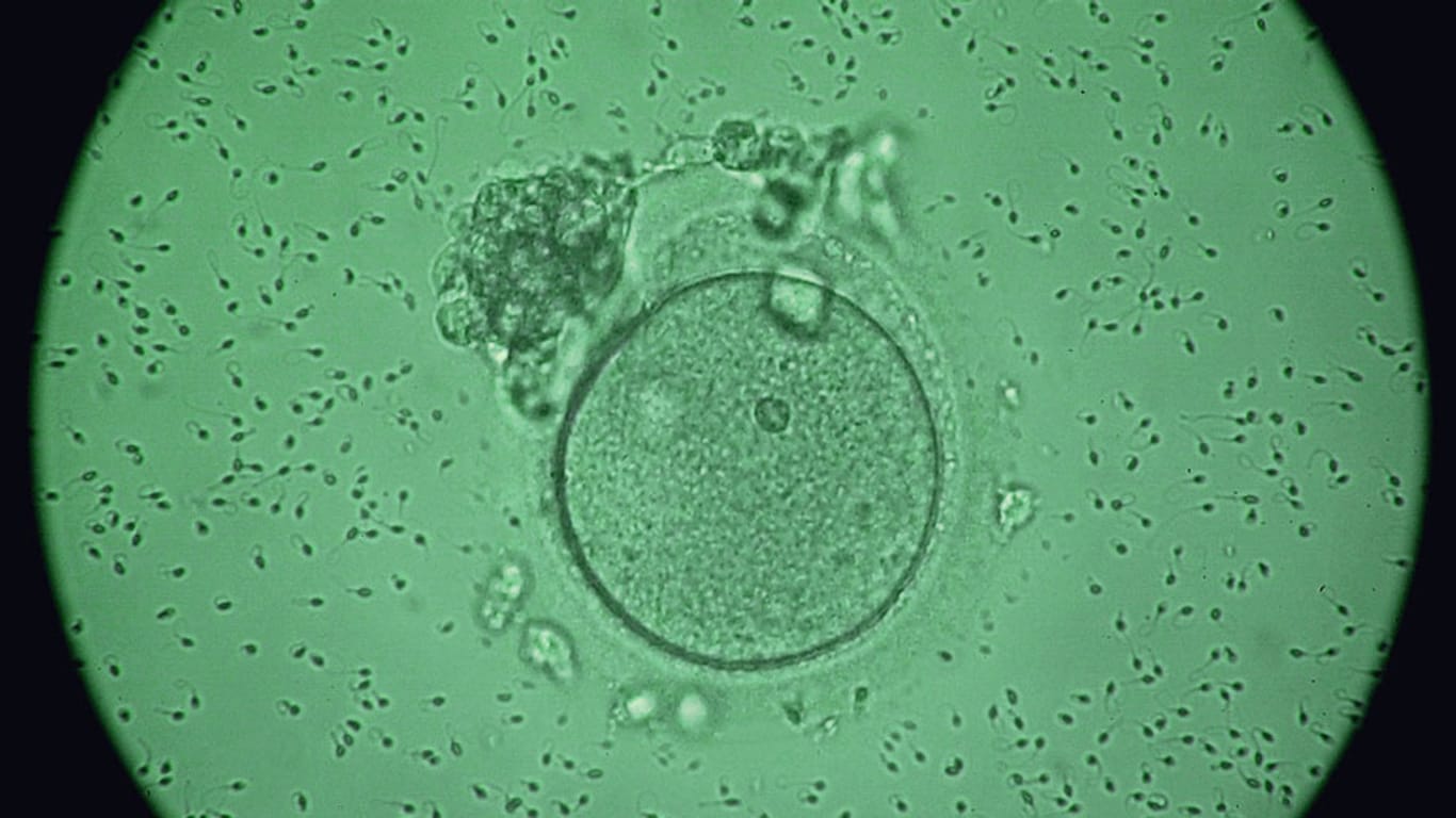 Kinderwunsch: Die mikroskopische Aufnahme zeigt eine menschliche Eizelle, die von Spermien umgeben ist.