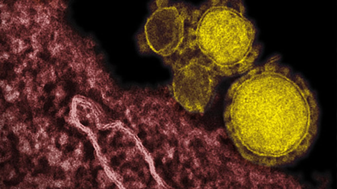 Das Mers-Virus ist laut WHO-Generaldirektorin Margaret Chan eine "Gefahr für die ganze Welt".
