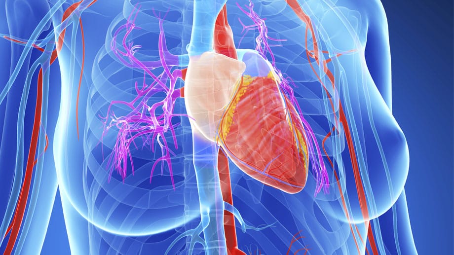 Jedes Jahr sterben in Deutschland 65.000 Menschen an einem Herzinfarkt. 55 Prozent davon sind Frauen.